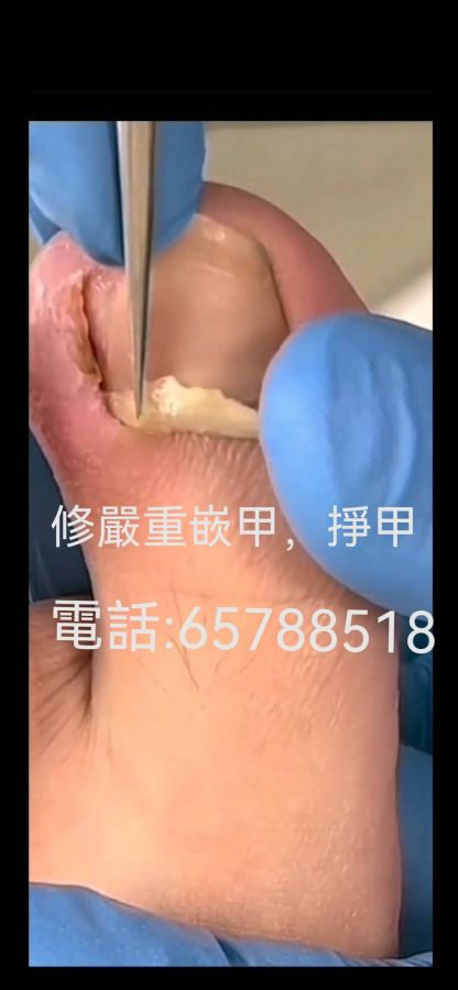 香港全師傅專業上海式修腳皮